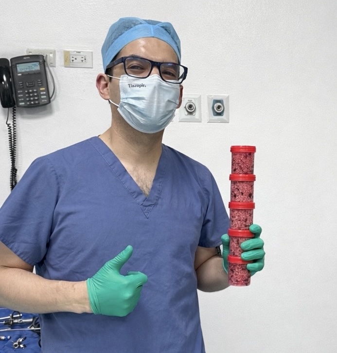Dr. Pineda sosteniendo espécimen de 410cc